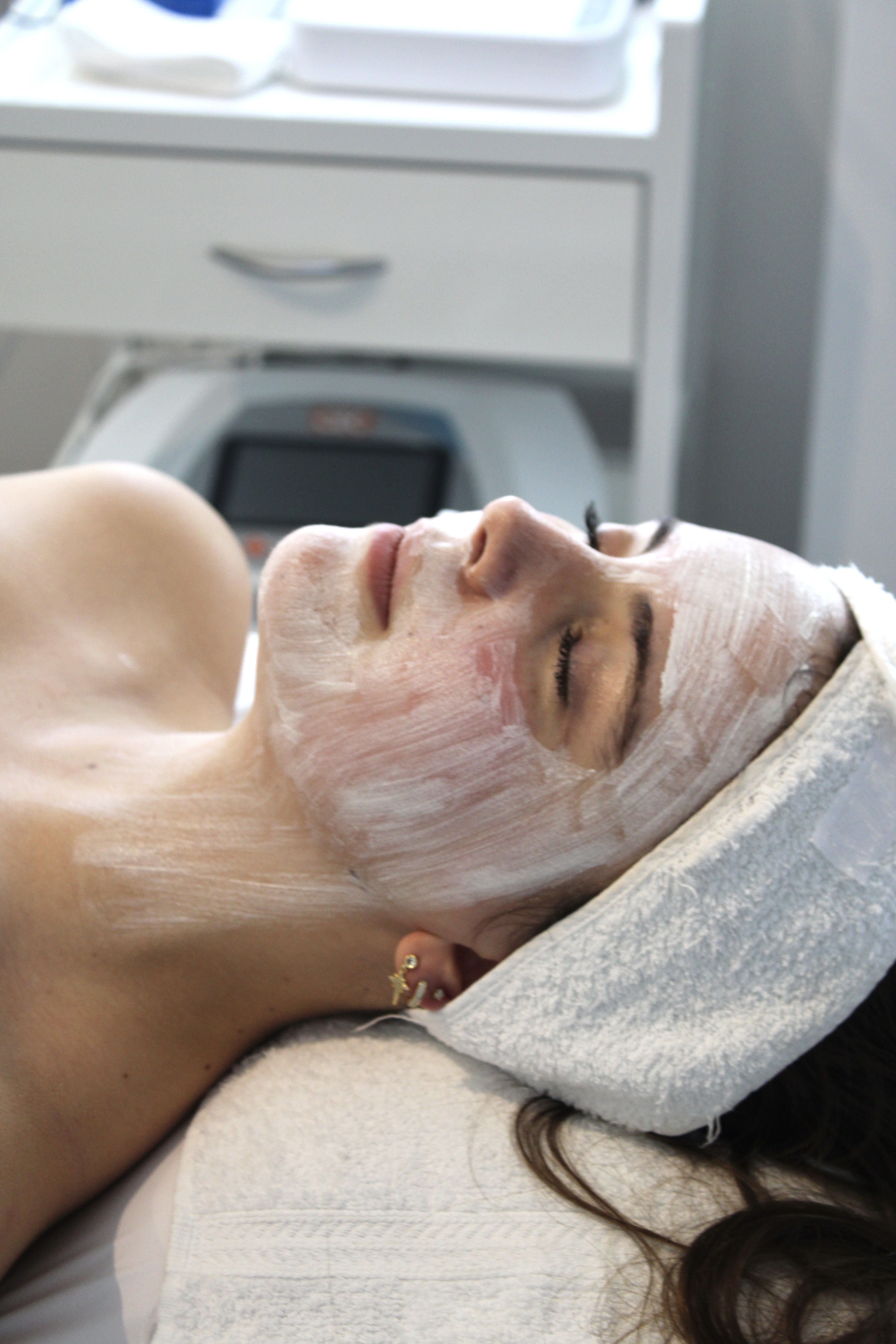 Peeling de Verano